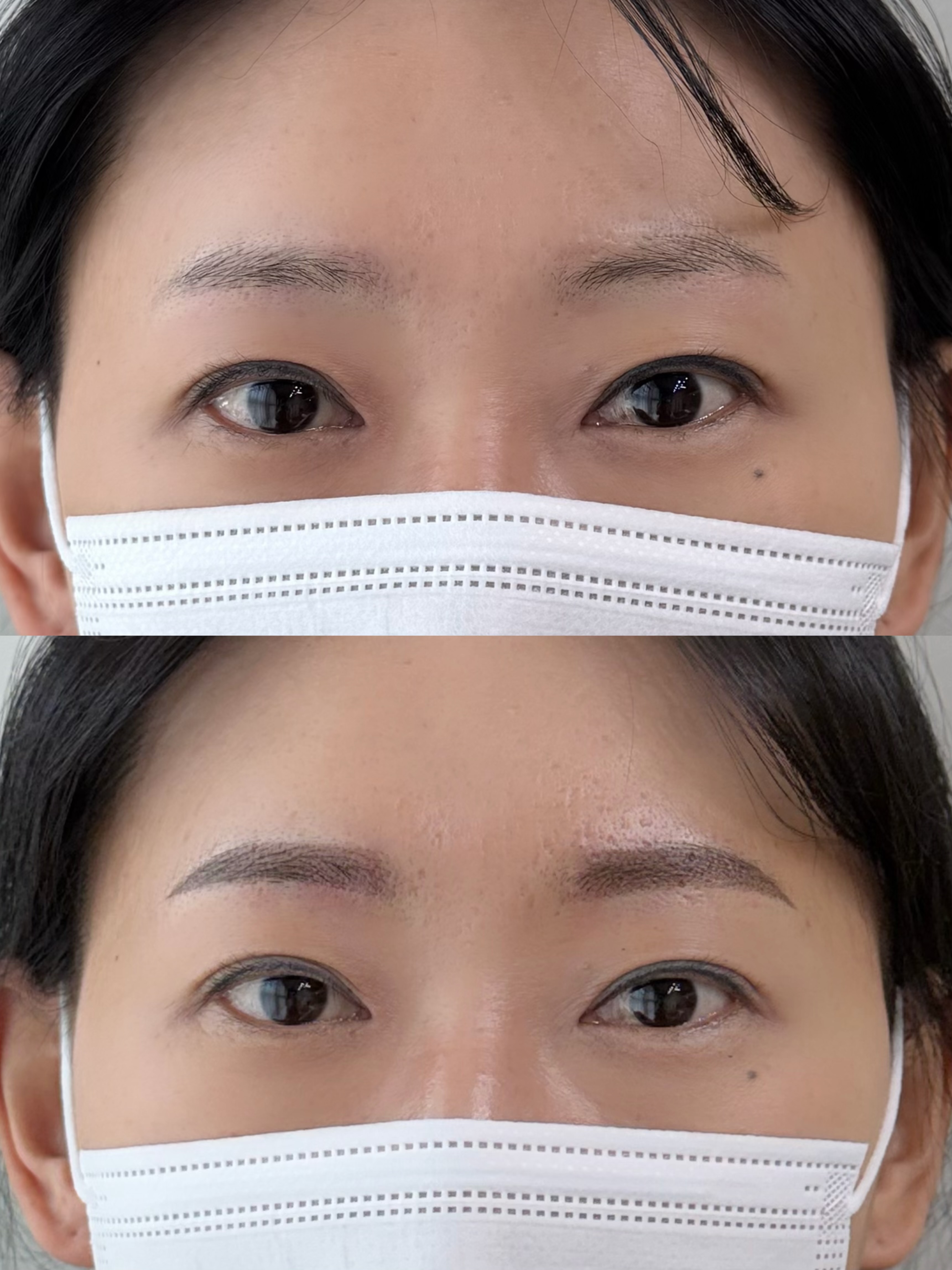 눈썹 문신 시술 사례 3